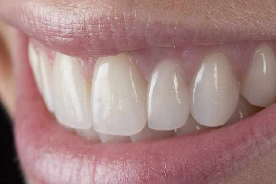 پوهشگران ژاپنی با اصلاح ژنتیکی رشد مجدد دندان در انسان را محقق می‌کنند