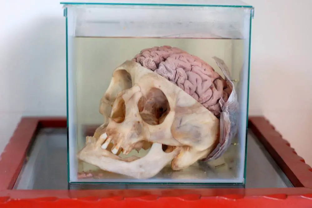 سفری دلهره‌آور به موزه مغز پرو!
